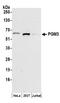 Phosphoacetylglucosamine mutase antibody, A304-555A, Bethyl Labs, Western Blot image 