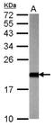 ADP-ribosylation factor 3 antibody, NBP2-15439, Novus Biologicals, Western Blot image 