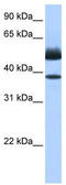 Lipase Family Member J antibody, TA339956, Origene, Western Blot image 