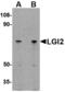 Leucine-rich repeat LGI family member 2 antibody, A13256, Boster Biological Technology, Western Blot image 