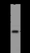 Patched Domain Containing 4 antibody, 206718-T36, Sino Biological, Western Blot image 