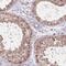 VPS52 Subunit Of GARP Complex antibody, HPA048128, Atlas Antibodies, Immunohistochemistry frozen image 