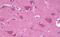 Frizzled Class Receptor 3 antibody, NLS4454, Novus Biologicals, Immunohistochemistry paraffin image 