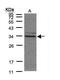 3-mercaptopyruvate sulfurtransferase antibody, PA5-28779, Invitrogen Antibodies, Western Blot image 