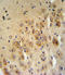 SERPINB2 antibody, LS-C99290, Lifespan Biosciences, Immunohistochemistry paraffin image 