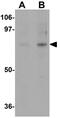 Acyl-CoA Binding Domain Containing 3 antibody, GTX31794, GeneTex, Western Blot image 