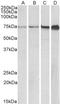 DNA-directed RNA polymerase I subunit RPA1 antibody, LS-C205059, Lifespan Biosciences, Western Blot image 