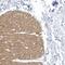 Zinc Finger Protein 846 antibody, NBP2-37874, Novus Biologicals, Immunohistochemistry paraffin image 