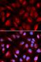 Minichromosome Maintenance Complex Component 5 antibody, LS-C334137, Lifespan Biosciences, Immunofluorescence image 