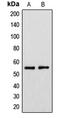 Cytochrome P450 Family 39 Subfamily A Member 1 antibody, LS-C353430, Lifespan Biosciences, Western Blot image 