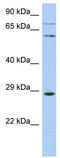 Zinc Finger Protein 490 antibody, TA339519, Origene, Western Blot image 