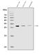Collagenase inhibitor antibody, A00561-2, Boster Biological Technology, Western Blot image 