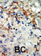 EPH Receptor A3 antibody, abx033514, Abbexa, Immunohistochemistry paraffin image 