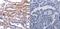CF Transmembrane Conductance Regulator antibody, TA323641, Origene, Immunohistochemistry paraffin image 