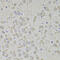 60S ribosomal protein L3 antibody, 15-349, ProSci, Immunohistochemistry frozen image 