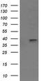 Mitogen-Activated Protein Kinase Kinase 3 antibody, TA505806BM, Origene, Western Blot image 