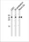Homeobox protein EMX1 antibody, TA325087, Origene, Western Blot image 