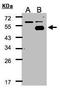 COUP transcription factor 1 antibody, TA308523, Origene, Western Blot image 