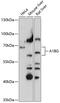 Alpha-1-B Glycoprotein antibody, 15-832, ProSci, Western Blot image 