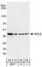 60S ribosomal protein L6 antibody, A303-587A, Bethyl Labs, Western Blot image 