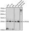 Lysophospholipase 2 antibody, A10621, Boster Biological Technology, Western Blot image 