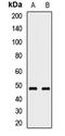 Ring Finger Protein 135 antibody, LS-C668349, Lifespan Biosciences, Western Blot image 