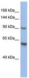 CDKN1A Interacting Zinc Finger Protein 1 antibody, TA335898, Origene, Western Blot image 
