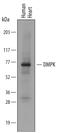 DM1 Protein Kinase antibody, MAB6967, R&D Systems, Western Blot image 