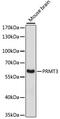 Protein Arginine Methyltransferase 3 antibody, A13068, ABclonal Technology, Western Blot image 