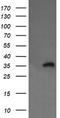 Kinesin Family Member 25 antibody, CF505428, Origene, Western Blot image 