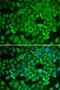 Nuclear receptor subfamily 0 group B member 1 antibody, LS-C335176, Lifespan Biosciences, Immunofluorescence image 