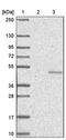 NPR2 Like, GATOR1 Complex Subunit antibody, PA5-58289, Invitrogen Antibodies, Western Blot image 
