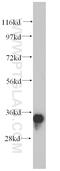 Protein Kinase AMP-Activated Non-Catalytic Subunit Beta 2 antibody, 14429-1-AP, Proteintech Group, Western Blot image 