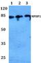 Nephrocystin 1 antibody, A03029, Boster Biological Technology, Western Blot image 
