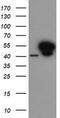 Annexin A7 antibody, TA504925S, Origene, Western Blot image 