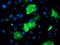 Epsin 2 antibody, MA5-25872, Invitrogen Antibodies, Immunocytochemistry image 