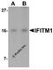Interferon Induced Transmembrane Protein 1 antibody, 5805, ProSci Inc, Western Blot image 