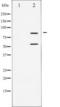 Phosphatidylinositol 3-kinase regulatory subunit alpha antibody, TA325781, Origene, Western Blot image 