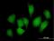 RRAD And GEM Like GTPase 1 antibody, H00028954-B01P, Novus Biologicals, Immunocytochemistry image 