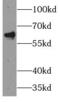 P21 (RAC1) Activated Kinase 4 antibody, FNab06123, FineTest, Western Blot image 