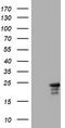 Visinin Like 1 antibody, TA801883S, Origene, Western Blot image 