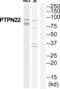Protein Tyrosine Phosphatase Non-Receptor Type 22 antibody, abx014968, Abbexa, Western Blot image 