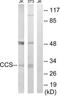 Copper Chaperone For Superoxide Dismutase antibody, LS-C119879, Lifespan Biosciences, Western Blot image 