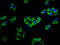 Adenylate cyclase type 5 antibody, LS-C680131, Lifespan Biosciences, Immunofluorescence image 
