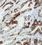Cytochrome P450 Family 2 Subfamily U Member 1 antibody, LS-C313146, Lifespan Biosciences, Immunohistochemistry paraffin image 