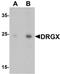 Dorsal Root Ganglia Homeobox antibody, orb75671, Biorbyt, Western Blot image 