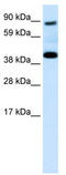 Serpin Family F Member 1 antibody, TA330022, Origene, Western Blot image 