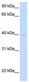 Solute Carrier Family 25 Member 36 antibody, TA333757, Origene, Western Blot image 