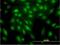 Serine/Threonine Kinase 4 antibody, H00006789-M02, Novus Biologicals, Immunofluorescence image 