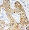 NADPH oxidase 5 antibody, PA1947, Boster Biological Technology, Immunohistochemistry paraffin image 